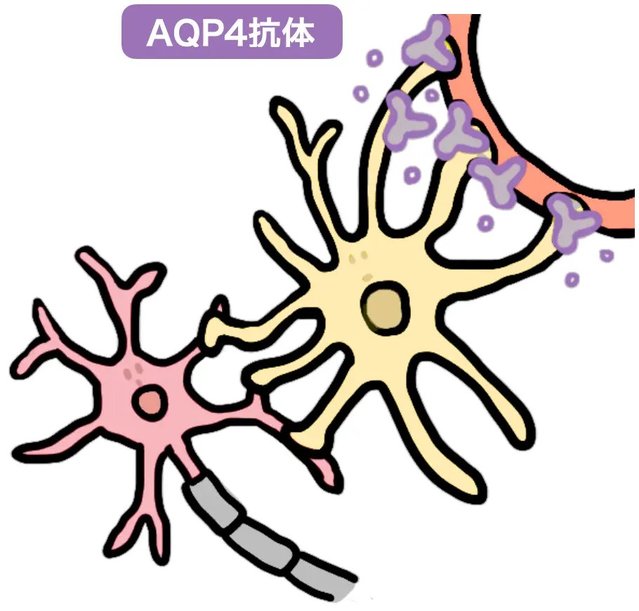 AQP4抗体がアストロサイトのAQP4に結びつく様子を示す模式図